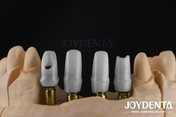 Tek veya Çoklu Birim Restorasyonları için Özel Diş İmplantı Zirkonya Abutment