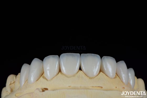 Parlak yüzey doku Feldspatik kaplama Doğal görünümlü porselen kaplama