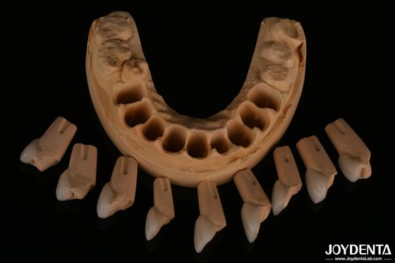 Dental Feldspathic Finer, Parlak yüzey dokusu ile çok doğal