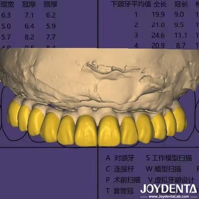 Diş Tasarımı Yazılımı HIPAA Uyumlu Veri Güvenliği ile Dijital Wax