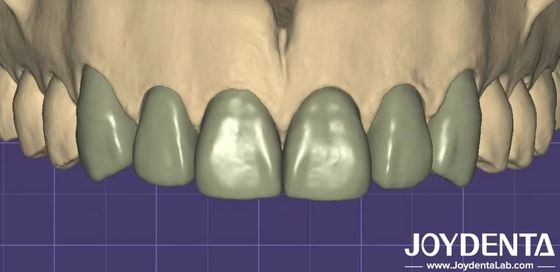 3D Baskı Sanal Dijital Balmumu Diğer Diş Yazılımları ile Kesin Uyumluluk