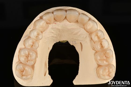 Yüksek Korozyona Direnci Tam Zirkonya Beyaz Diş Restorasyonları için Tercih Edilen Malzeme