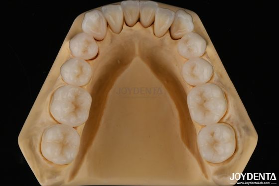 3 boyutlu çok katmanlı diş tıbbi tam zirkonya parçalanma direnci doğal diş yapısı