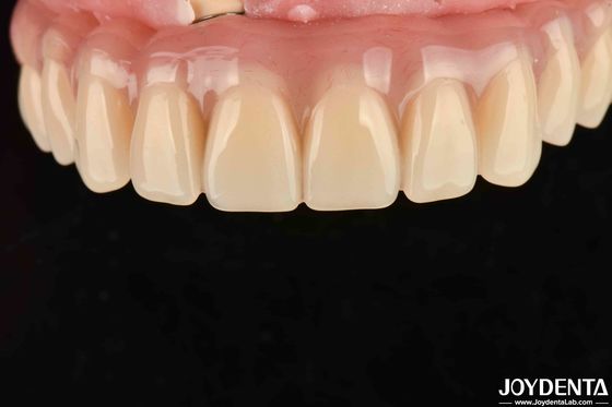 Hızlı kurutma 5 dakikalık Acrylic Diş Finish Diş Restorasyonu