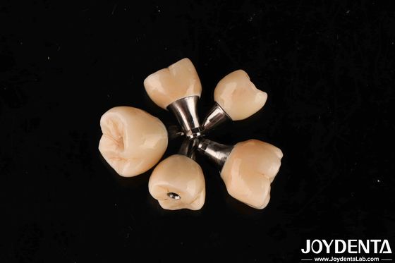 Dental implantlar için vida retensiyon titanyum abutments iç hex bağlantı