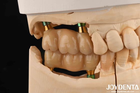 4.5mm Yükseklik Yumuşatılmış İç Hex Diş İmplantı Abutments V Şekilli vida Tutuldu