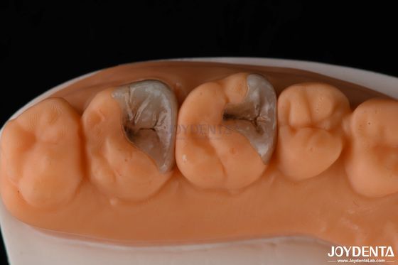 Diş Restorasyonu İçin Kompozit Yapılandırmalar ve Yapılandırmalar Diş Yapısına Güçlü Bağlama