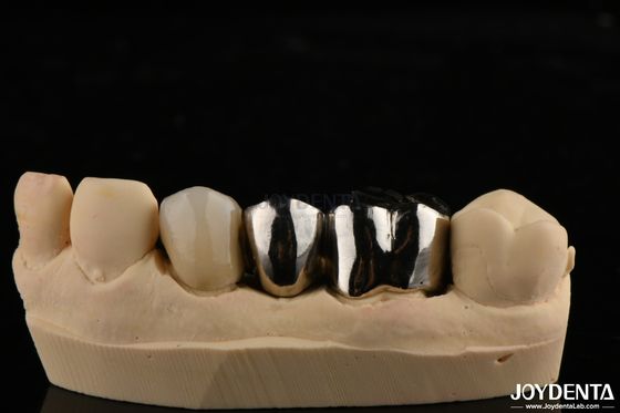 Kişisel Diş Restorasyonları için Sıvışmaya Dirençli Metal Alaşım Tacı