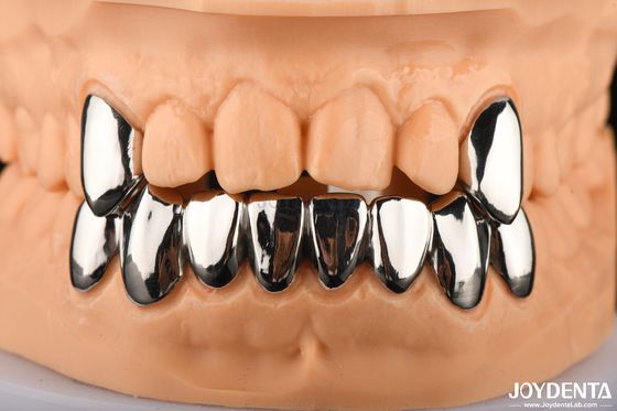 Dental abrazif dayanıklı taç tam metal, metal FMC Ağız rehabilitasyonu için