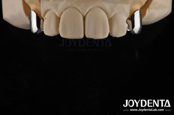 Kesinlikle çıkarılabilir protez Dental implant eklemleri Kolay Temiz Konforlu Uyumlu