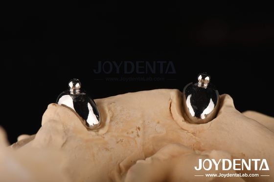 Joydental diş laboratuvarı top takımı