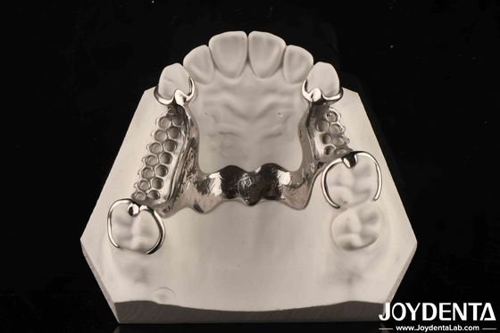 Klinik Uygulama Diş Alaşımlı Metal Çerçeve Ağız Teknolojisi