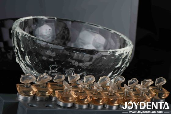 Kozmetik Diş Hekimliği Pürüzlü Porselen Finer Temizlenmesi Kolay ve Sıcaklığa Direniyor