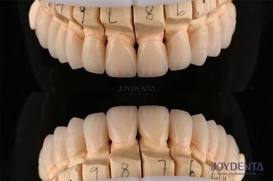 CAD CAM teknolojisi ile 0.3-0.5mm kalınlığında cilalanmış katmanlı diş zirkonyası