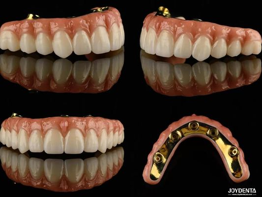 Diş protezi için Ti Bar Zirconia Hibrit İmplant Köprüleri Yüksek Şeffaflık