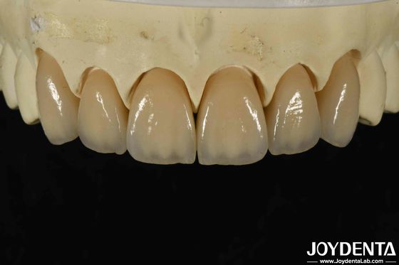 Mükemmel Biyolojik Uyumluluk Yüksek Estetik İçin Katmanlı Zirkonya Ve Nitelik 6.0-6.1 G / cm3