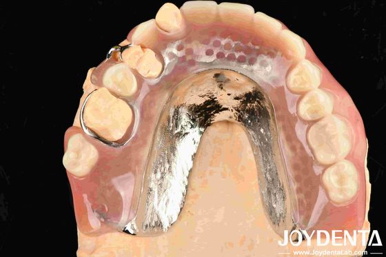Güzel ve uyumlu çerçeve Diş Tedavisi Odaları için Diş Finishini Ayarlayın