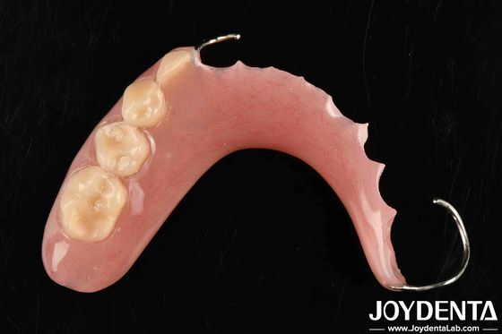 Dental uygulamada sabit ağız yapısı çerçevesi için geliştirilmiş teknoloji