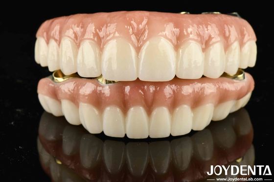 Yüksek Dayanıklılık Ti-Bar Zirconia Hibrit Köprüsü Estetik Başarmak İçin