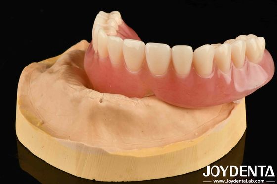 İyi Elastiklik Akrilik Diş Dentisi Doğal Görünümlü Sonuçlar İçin Çeşitli Diş Düzenlemesi Teknolojisi