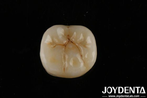 Yüksek şeffaflıklı tam zirkonya katmanlı biyo uyumluluk ve bükme dayanıklılığı 800 MPa