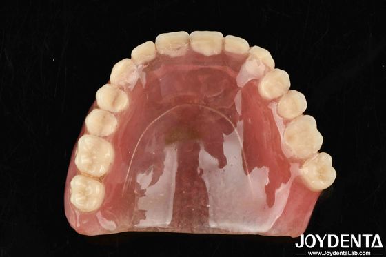 İyi Elastiklik Rezin Malzemesi Performansı ve Dayanıklılığı Artıran Ürünler İçin Akrilik Dentik Dönüşümü