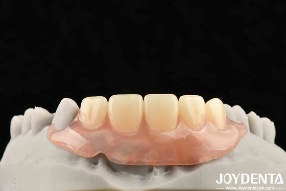 Dental teknolojide istikrarlı bir ağız yapısı için diş bitirmeyi oluşturan teknolojik çerçeveyi geliştirin