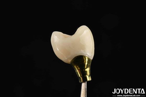 Farklı Boyutlar Dental implantlar için Dental Crown ve Köprü