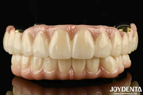 Mükemmel Güçlü Ti-Bar Zirconia Hibrit Köprüsü Doğal Dişler ve Dişekler için Uyumluluk