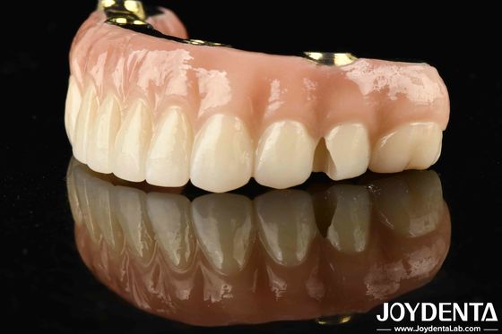 Diş Restorasyonunuzu Ti-Bar Zirconia Hibrit Köprüsüyle Değiştirin