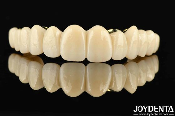 Özel yapılmış Ti-Bar Zirconia Hibrit Köprüsü Rahatlık ve İşlevsellik için mükemmel bir kombinasyon