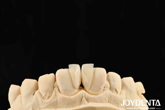 Yüksek dayanıklılık mikro kaplama 0.2 mm kalınlığı ve güvenilir performans