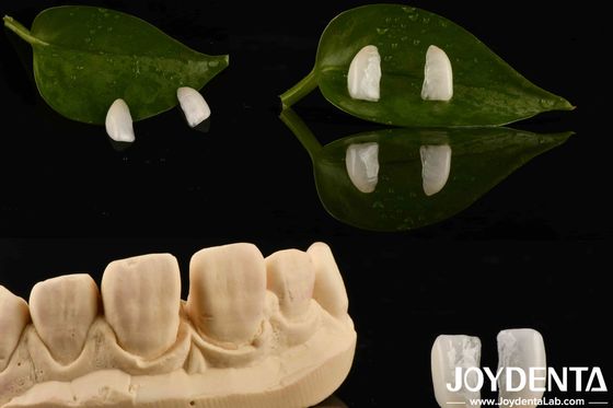 Yüksek Dayanıklılık Doğal Ahşap 0.2mm Kalınlığında Ultra İnce Mikro Finer
