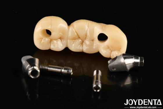 Yapılandırılabilir tasarımlı implant tacı ve köprüsü Yüksek dayanıklılık Doğru uyum