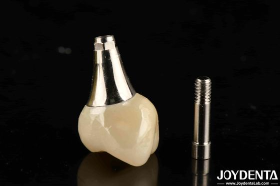 Biyo uyumlu diş implantı tacı ve köprüsü güvenli oral için estetik olarak hoş