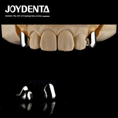 Kesinlikle çıkarılabilir protez Dental implant eklemleri Kolay Temiz Konforlu Uyumlu