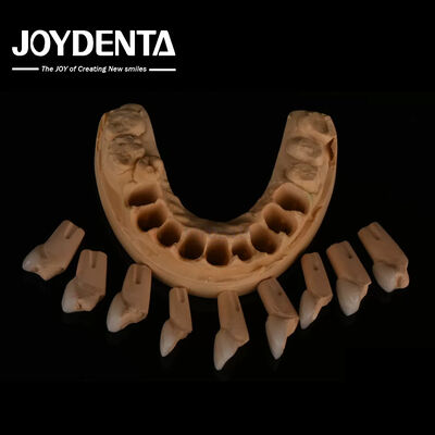 Dental Feldspathic Finer, Parlak yüzey dokusu ile çok doğal